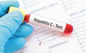Niue population to undergo tests for hepatitis B and C