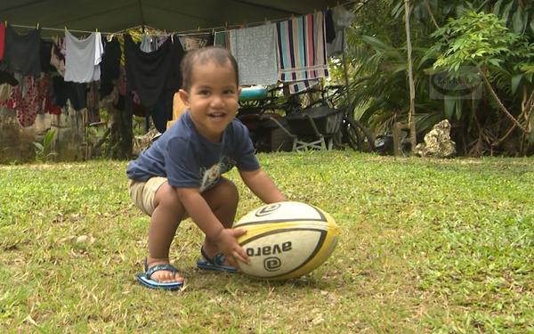 One year old boy recovers from traumatic brain injury against all odds